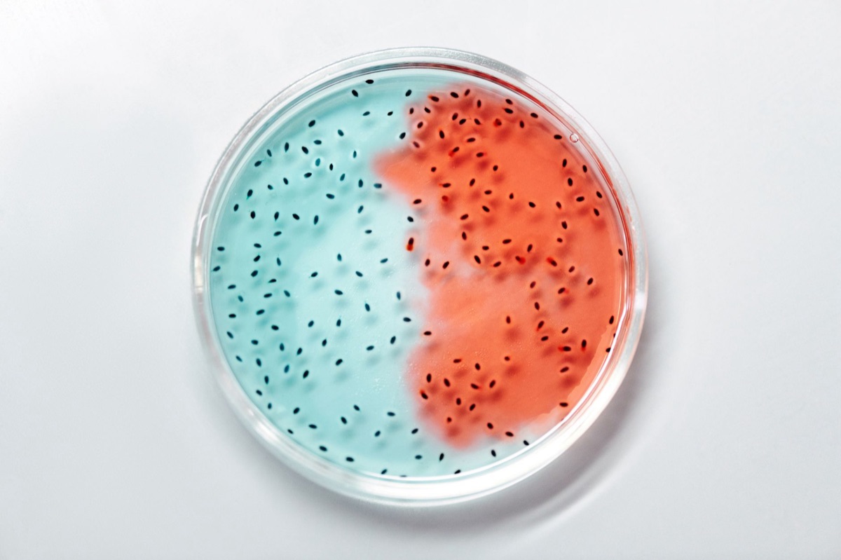 lab equipment analyzing microorganisms
